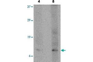 Western blot analysis of P53AIP1 in HL-60 cell lysate with P53AIP1 polyclonal antibody  at 4 and 8 ug/mL . (TP53AIP1 Antikörper  (N-Term))