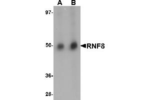 Western Blotting (WB) image for anti-Ring Finger Protein 8 (RNF8) (C-Term) antibody (ABIN1030625)