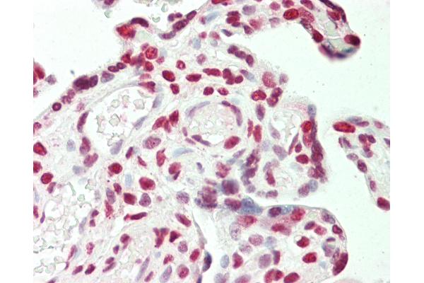 Stromal Antigen 1 Antikörper  (AA 25-75)