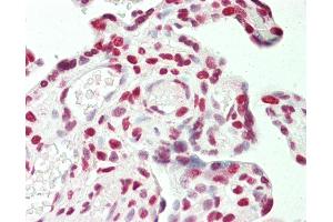 Anti-STAG1 / SA1 antibody IHC staining of human placenta. (Stromal Antigen 1 Antikörper  (AA 25-75))