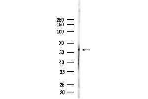 anti-Megakaryocyte-Associated tyrosine Kinase (MATK) (Internal Region) antibody