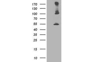 Western Blotting (WB) image for anti-Proteasome (Prosome, Macropain) 26S Subunit, Non-ATPase, 2 (PSMD2) antibody (ABIN1500481) (PSMD2 Antikörper)