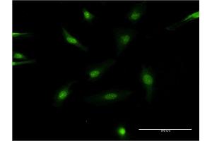 Immunofluorescence of monoclonal antibody to SRC on HeLa cell. (Src Antikörper  (AA 1-90))