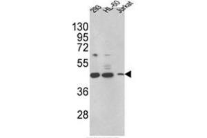 Western blot analysis of HSD17B7 Antibody (HSD17B7 Antikörper  (N-Term))