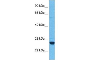 Host:  Rabbit  Target Name:  HPGDS  Sample Tissue:  Human Ovary Tumor  Antibody Dilution:  1ug/ml (PTGDS Antikörper  (N-Term))