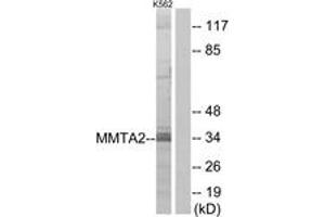Western blot analysis of extracts from K562 cells, using MMTAG2 Antibody. (C1orf35 Antikörper  (AA 10-59))