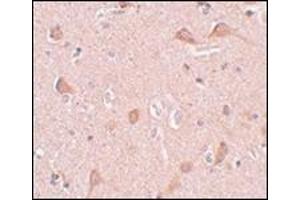 Immunohistochemistry of SIPA1L1 in human brain tissue with this product at 5 μg/ml. (SIPA1L1 Antikörper  (N-Term))