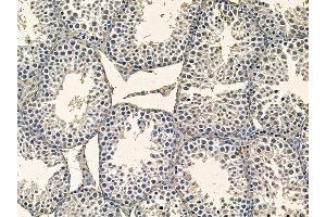 ABIN7095364 and ABIN7099421 at 1/100 staining mouse testis tissue by IHC-P. (WDR76 Antikörper)