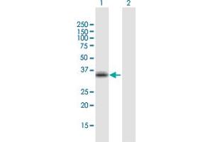 Western Blot analysis of CCR5 expression in transfected 293T cell line by CCR5 MaxPab polyclonal antibody. (CCR5 Antikörper  (AA 1-352))