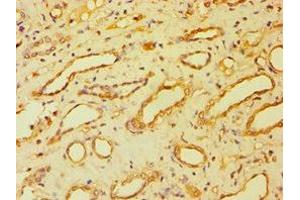 Immunohistochemistry (IHC) image for anti-Bartter Syndrome, Infantile, with Sensorineural Deafness (Barttin) (BSND) (AA 54-320) antibody (ABIN7145262)