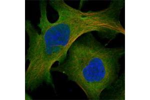 Immunofluorescent staining of human cell line U-2 OS shows positivity in nucleoli, plasma membrane & cytoplasm.