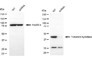 Western blotting analysis using fumarate hydratase antibody (ABIN7798663). (FH Antikörper)