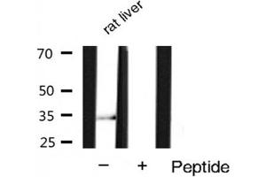 Western blot analysis of extracts of Rat liver lysates,using Phospho-Cyclin D1 (Ser90) Antibody . (Cyclin D1 Antikörper  (pSer90))