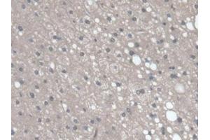 Immunohistochemistry (IHC) image for anti-Regucalcin (RGN) (AA 65-299) antibody (ABIN7440923)