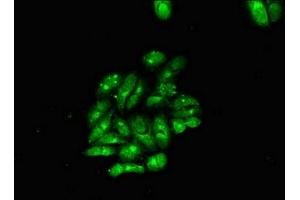 Immunofluorescent analysis of Hela cells using ABIN7160401 at dilution of 1:100 and Alexa Fluor 488-congugated AffiniPure Goat Anti-Rabbit IgG(H+L) (MBP Antikörper  (AA 1-197))