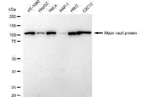 Western blotting analysis using Major vault protein antibody (ABIN7799325).