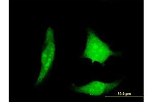 Immunofluorescence of monoclonal antibody to RCAN1 on HeLa cell.