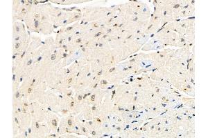 Phospho-ATM (Tyr370) Antibody at 1/100 staining Mouse heart tissue by IHC-P.