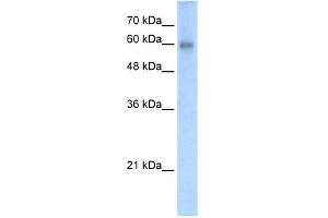 WB Suggested Anti-RCOR2 Antibody Titration:  5. (Rcor2 Antikörper  (N-Term))