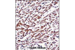 Immunohistochemistry (Formalin/PFA-fixed paraffin-embedded sections) of human heart tissue with MOV10 polyclonal antibody  followed by peroxidase conjugation of the secondary antibody and DAB staining. (MOV10 Antikörper  (AA 260-288))