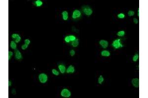 Anti-HOXC11 mouse monoclonal antibody (ABIN2454335) immunofluorescent staining of COS7 cells transiently transfected by pCMV6-ENTRY HOXC11 (RC201475). (HOXC11 Antikörper)