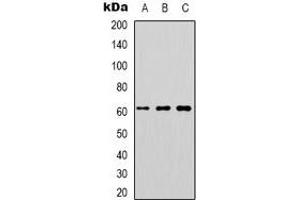 Western blot analysis of DOK1 expression in K562 (A), Jurkat (B), RAW264.