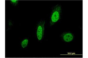 Immunofluorescence of monoclonal antibody to BIRC7 on HeLa cell. (BIRC7 Antikörper  (AA 1-90))