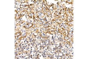 Immunohistochemistry of paraffin-embedded human spleen using BST2 Rabbit pAb (ABIN6129547, ABIN6137673, ABIN6137675 and ABIN6215924) at dilution of 1:100 (40x lens). (BST2 Antikörper  (AA 49-161))