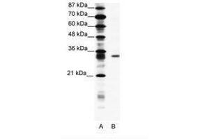 Image no. 1 for anti-Kv Channel Interacting Protein 4 (KCNIP4) (AA 27-76) antibody (ABIN202125) (KCNIP4 Antikörper  (AA 27-76))