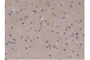 IHC-P analysis of Human Brain Tissue, with DAB staining. (IGFBPI Antikörper  (AA 36-235))