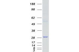 Validation with Western Blot (MAP2K3 Protein (Transcript Variant A) (Myc-DYKDDDDK Tag))