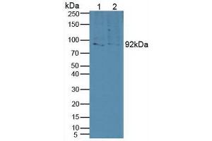 Figure. (Sortilin 1 Antikörper  (AA 50-320))