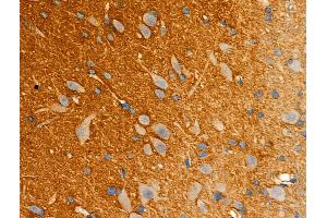 ABIN6261879 and ABIN6277946 at 1/100 staining Rat brain tissue by IHC-P. (GAP43 Antikörper  (C-Term))