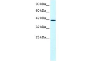 Western Blotting (WB) image for anti-PTK2B Protein tyrosine Kinase 2 beta (PTK2B) antibody (ABIN2460534)
