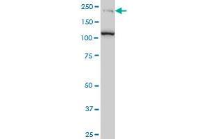 CDC42BPB monoclonal antibody (M04), clone 2D8 Western Blot analysis of CDC42BPB expression in Jurkat . (CDC42BPB Antikörper  (AA 1580-1679))