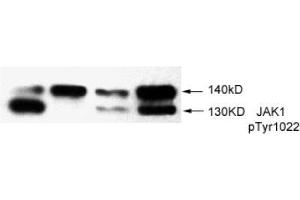 Image no. 2 for anti-Janus Kinase 1 (JAK1) (pTyr1022) antibody (ABIN196868) (JAK1 Antikörper  (pTyr1022))