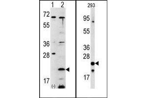 (LEFT)Western blot analysis of FXN (arrow) using rabbit polyclonal FXN Antibody (C-term). (Frataxin Antikörper  (C-Term))