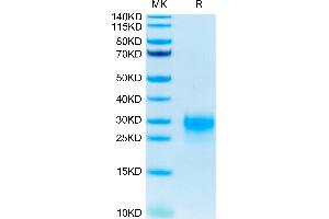 Human TSLP (R127A, R130A) on Tris-Bis PAGE under reduced condition. (Thymic Stromal Lymphopoietin Protein (TSLP) (Arg127Ala-Mutant, Arg130Ala-Mutant) (His-Avi Tag))