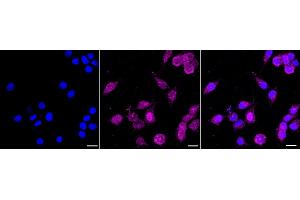 Immunocytochemical staining of HeLa cells with NDUFA13 antibody (ABIN7799542), 1:1,000). (Rekombinanter NDUFA13 Antikörper)