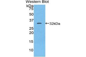 Western blot analysis of the recombinant protein. (CD103 Antikörper  (AA 671-917))