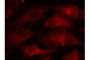 Immunofluorescence staining of methanol-fixed Hela cells using Caveolin-1(Phospho-Tyr14) Antibody. (Caveolin-1 Antikörper  (pTyr14))