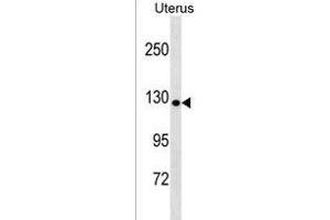 COL19A1 Antibody (N-term) (ABIN1539125 and ABIN2850306) western blot analysis in Uterus tissue lysates (35 μg/lane). (COL19A1 Antikörper  (N-Term))