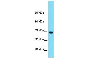 Western Blotting (WB) image for anti-H2B Histone Family, Member M (H2BFM) (Middle Region) antibody (ABIN2774481) (H2bfm Antikörper  (Middle Region))