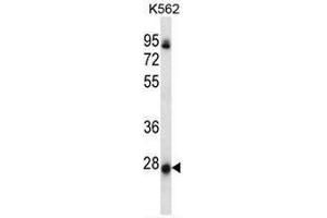 NRSN2 Antibody (C-term) western blot analysis in K562 cell line lysates (35µg/lane). (NRSN2 Antikörper  (C-Term))