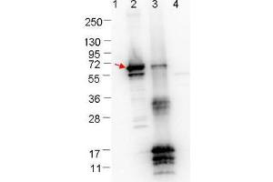 Western blot showing detection of 0. (ErpN/OspE Antikörper)