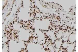 ABIN6273541 at 1/100 staining Rat lung tissue by IHC-P. (JMJD2D Antikörper  (N-Term))