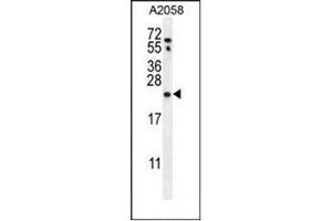 Western Blotting (WB) image for anti-RAB10, Member RAS Oncogene Family (RAB10) (AA 96-125), (Middle Region) antibody (ABIN954403)