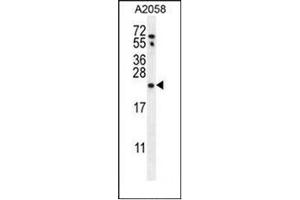 western blot analysis  of RAB10 Antibody (Center) in A2058 cell line lysates (35ug/lane). (RAB10 Antikörper  (Middle Region))