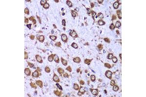 Immunohistochemistry of paraffin-embedded mouse brain using RPS10 antibody at dilution of 1:100 (x40 lens). (RPS10 Antikörper)