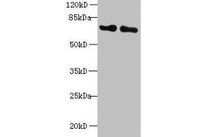 Western blot All lanes: KEAP1 antibody at 2 μg/mL Lane 1: Mouse kidney tissue Lane 2: NIH/3T3 whole cell lysate Secondary Goat polyclonal to rabbit IgG at 1/10000 dilution Predicted band size: 70 kDa Observed band size: 70 kDa